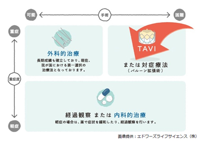 ASの治療方法の説明図　画像提供：エドワードライフサイエンス株式会社