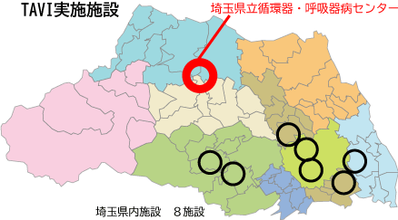 埼玉県内TAVI実施施設地図