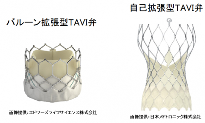 TAVI弁サンプル画像　バルーン拡張型TAVI弁の画像（画像提供：エドワーズライフサイエンス株式会社）　自己拡張型TAVI弁（画