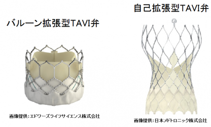 TAVI弁サンプル画像