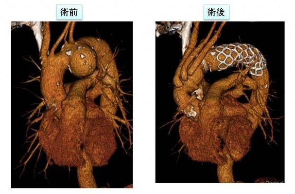 術前と術後の写真