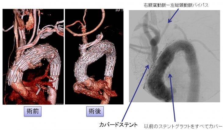 術前と術後の写真
