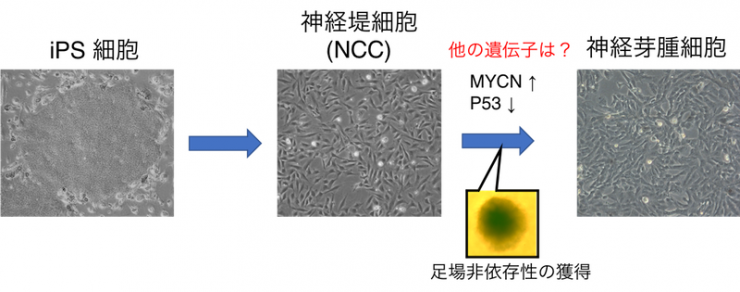 神経芽腫発がん機構解析における足場非依存性獲得の図（画像）