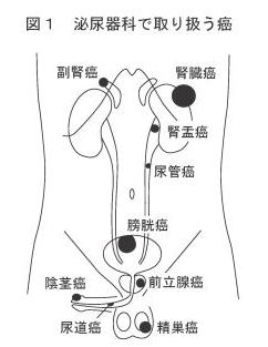 図1 泌尿器科で取り扱う癌