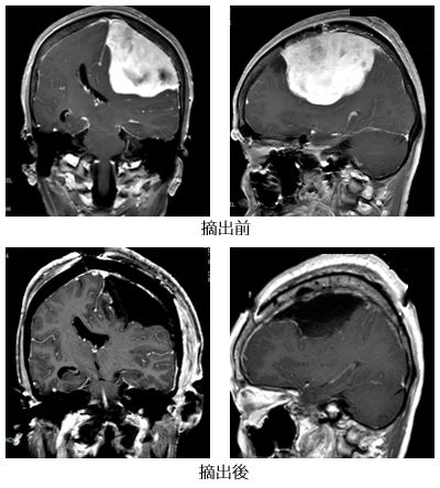 治療前後の比較画像10