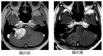治療前後の比較画像11