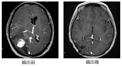 治療前後の比較画像12
