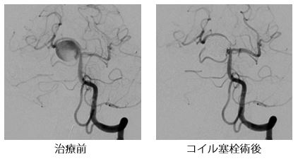 治療前後の比較画像1