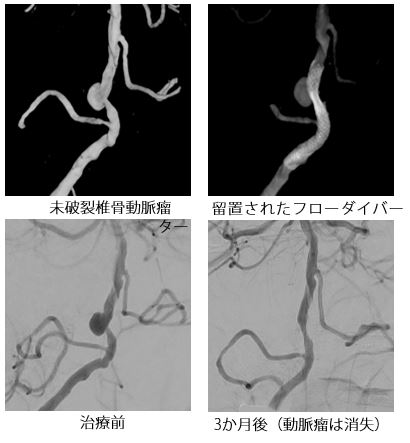 治療前後の比較画像2