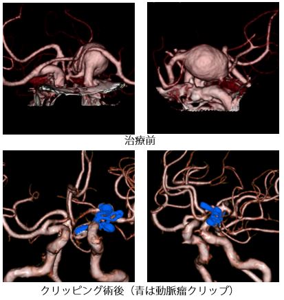 治療前後の比較画像3