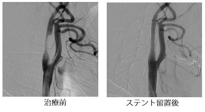 治療前後の比較画像4