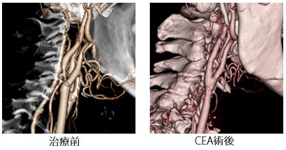 治療前後の比較画像5