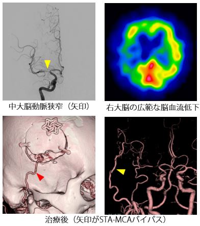 治療前後の比較画像6