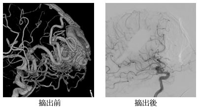 治療前後の比較画像7