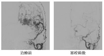 治療前後の比較画像8