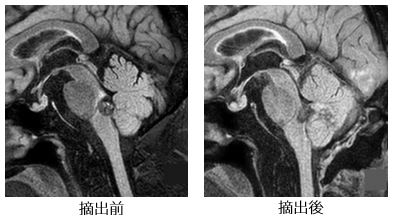 治療前後の比較画像9