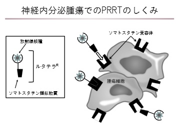 PRRTのしくみ