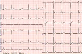 心電図検査2