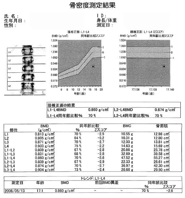 骨密度測定結果2