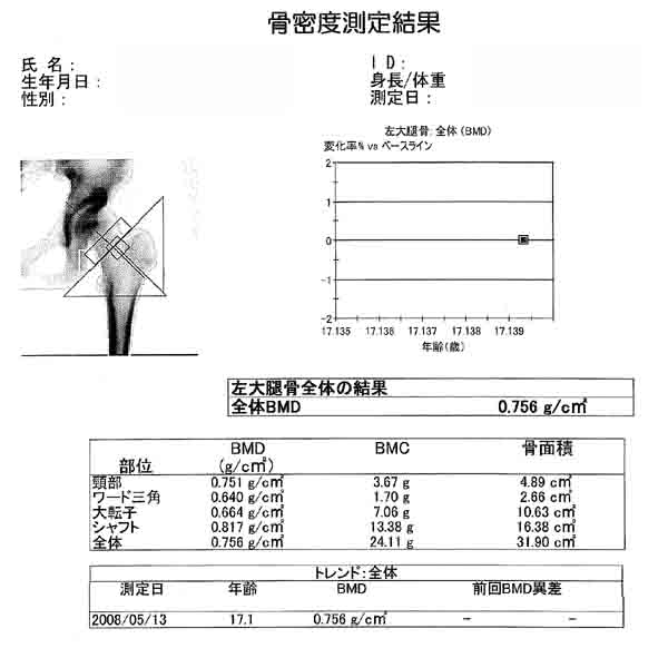 骨密度測定結果4